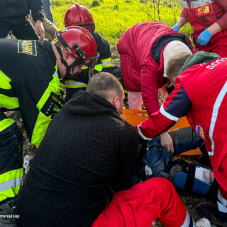 Травмував ногу.