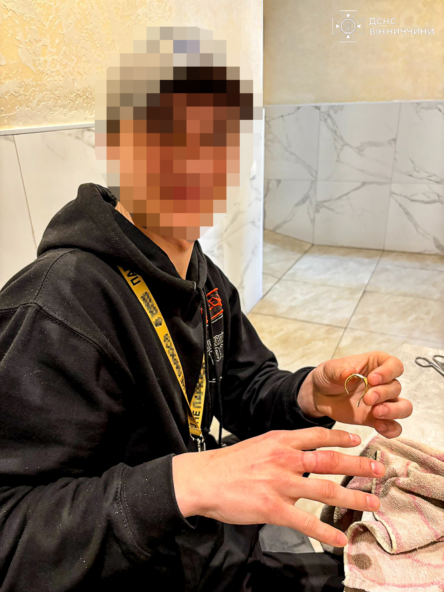 Рятувальники звільнили вінничанина від перстня, який перетиснув палець