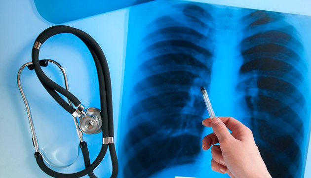 У Вінницькій області у березні зафіксували 42 випадки туберкульозу