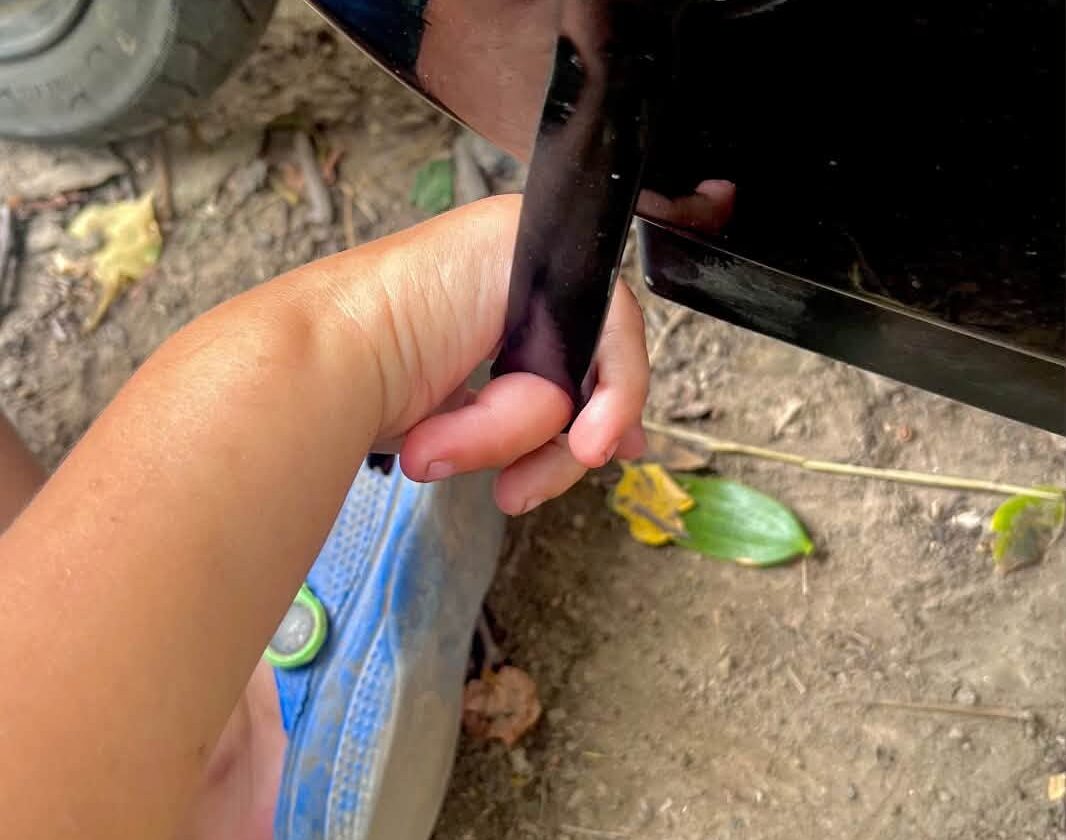 На Вінниччині рятувальники надали допомогу чотирирічному хлопчикові