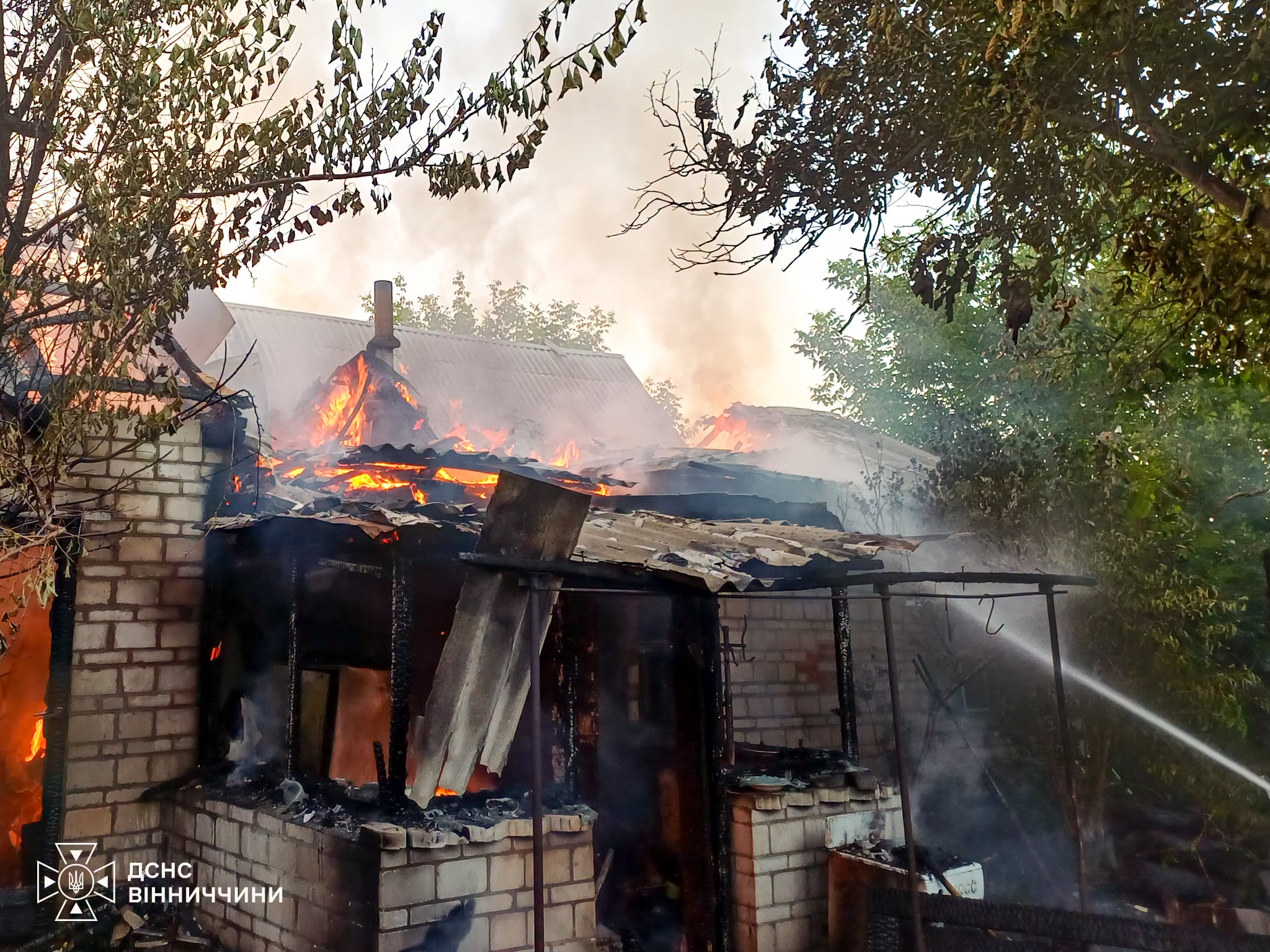 Від вогню на Вінниччині постраждала 80-річна жінка